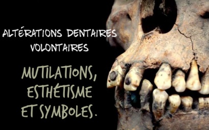 Altérations Et Mutilations Dentaires Volontaires